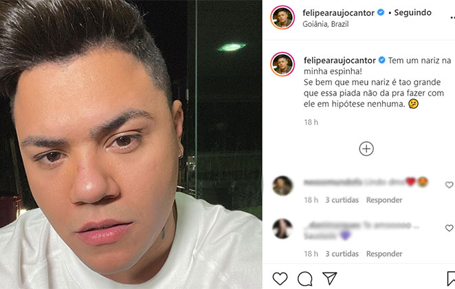 Felipe Araújo reclama do tamanho da espinha em seu nariz