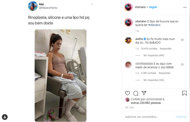 Anitta diz em post já ter feito vários procedimentos estéticos em um único dia