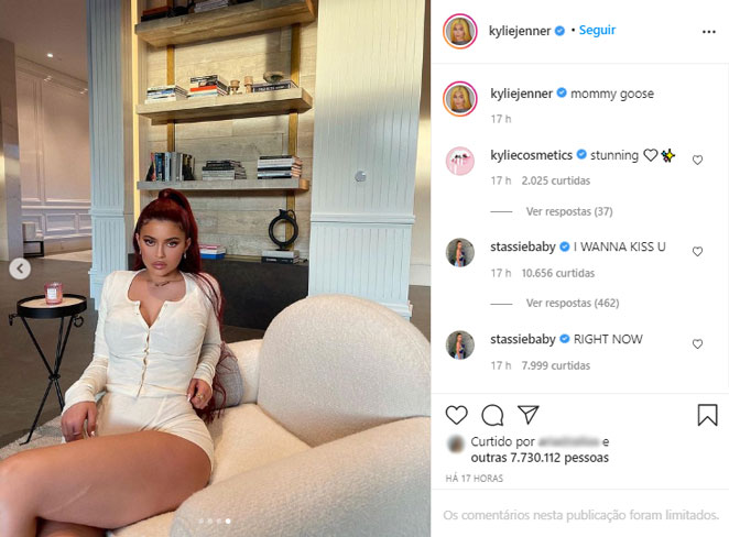 Kylie Jenner exibe cicatriz em sua perna ao compartilhar fotos calientes