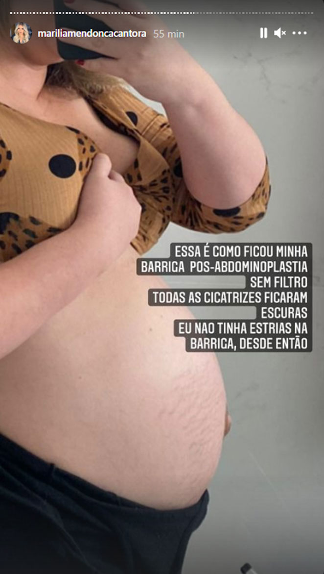 Marília Mendonça mostra foto inéditas do corpo durante a gestação