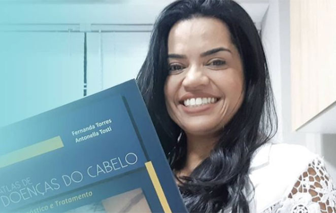 A Tricologista Viviane Coutinho esclarece dúvidas sobre alopecia areata