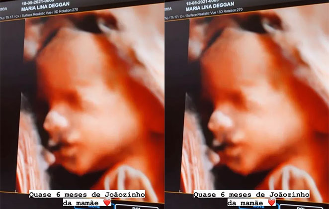 Maria Lina mostra rostinho do filho em ultrassom