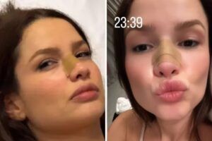 Juliette sofre acidente doméstico