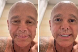 Netinho termina terceira fase do tratamento