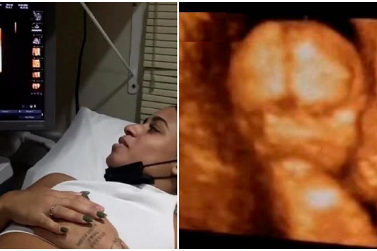 MC Loma vendo o ultrassom de seu primeiro bebê