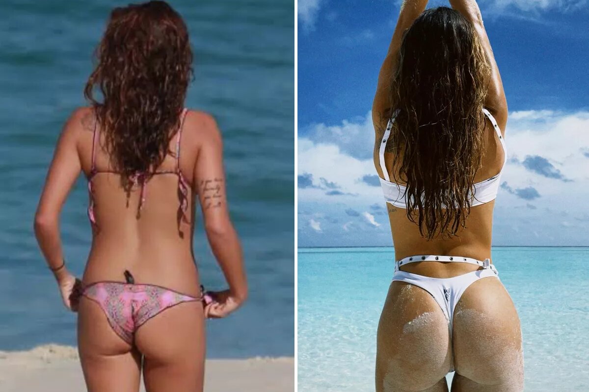 Antes e depois do bumbum de Mariana Goldfarb