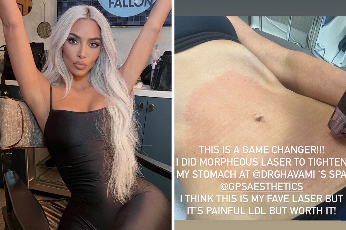 Kim Kardashian mostra tratamento na barriga