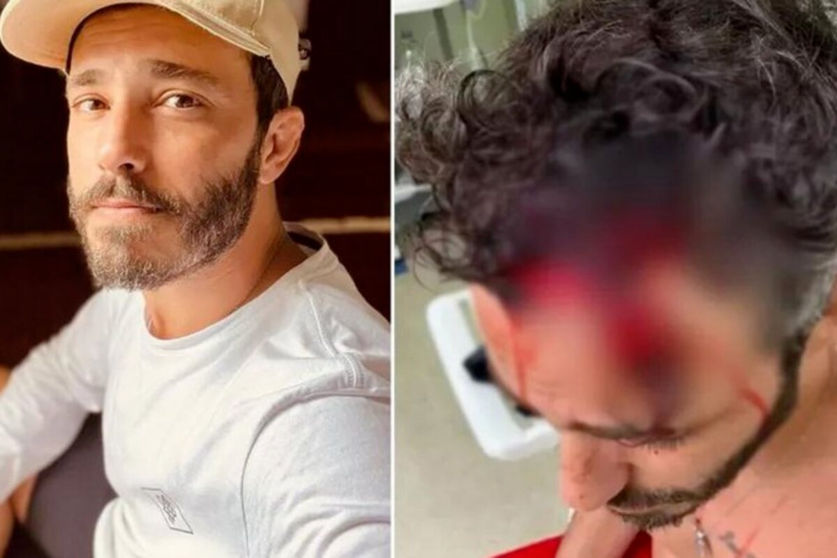 Thiago Rodrigues de camisa branca e boné e imagem do ator ferido ensanguentado
