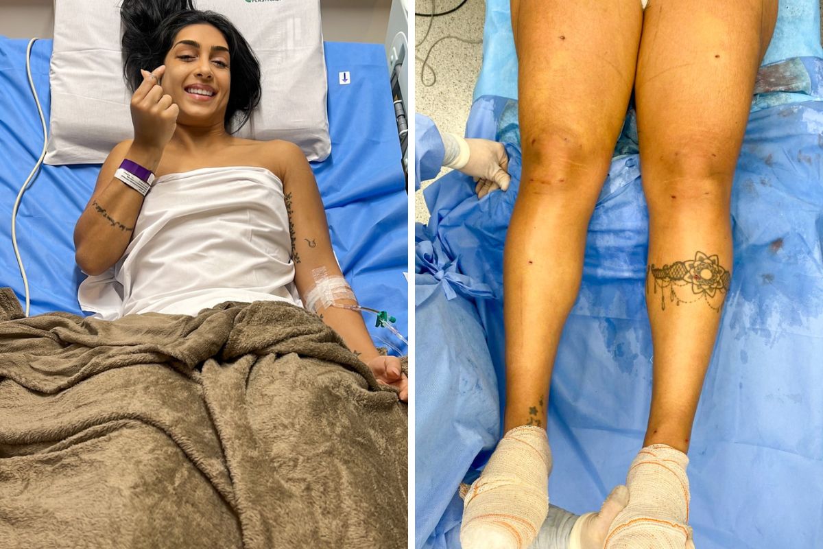 Ex-BBB Amanda Djehdian exibe bumbum e mostra como tratamento tem melhorado  lipedema - Primeira Hora