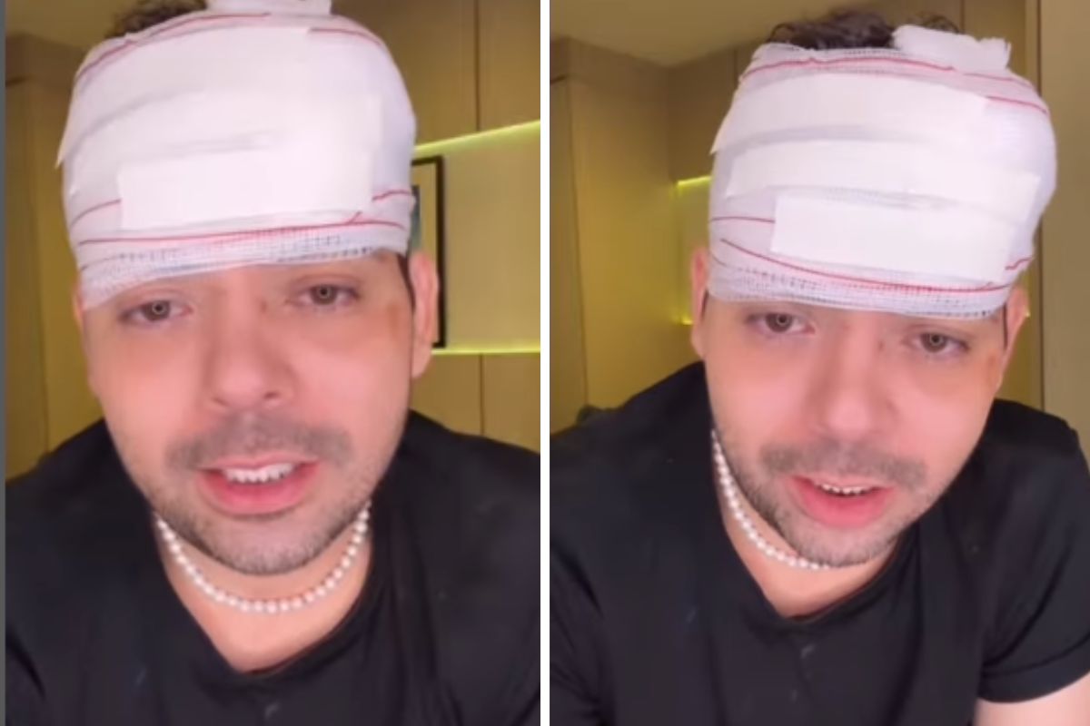 Gustavo Mendes com faixa na cabeça após tentativa de assalto
