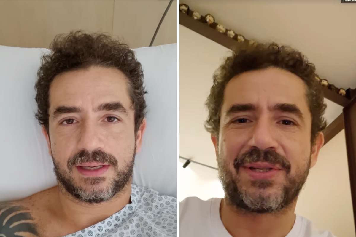 Felipe Andreoli passa por cirurgia