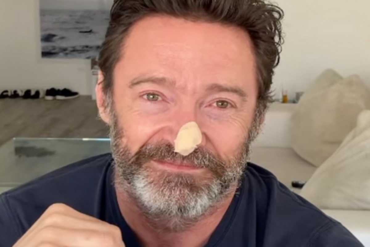 Hugh Jackman com curativo no nariz