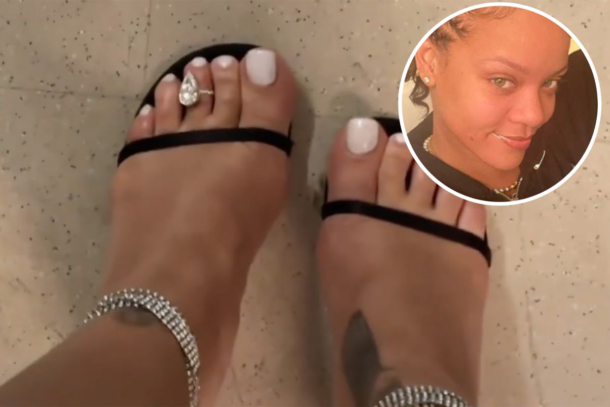 Rihanna lança nova moda milionária: usar anel de diamante no dedo do pé. A joia da cantora está avaliada em 1 milhão de dólares.