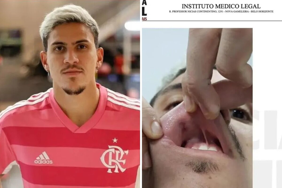 Pedro Guilherme, jogador do Flamengo agredido