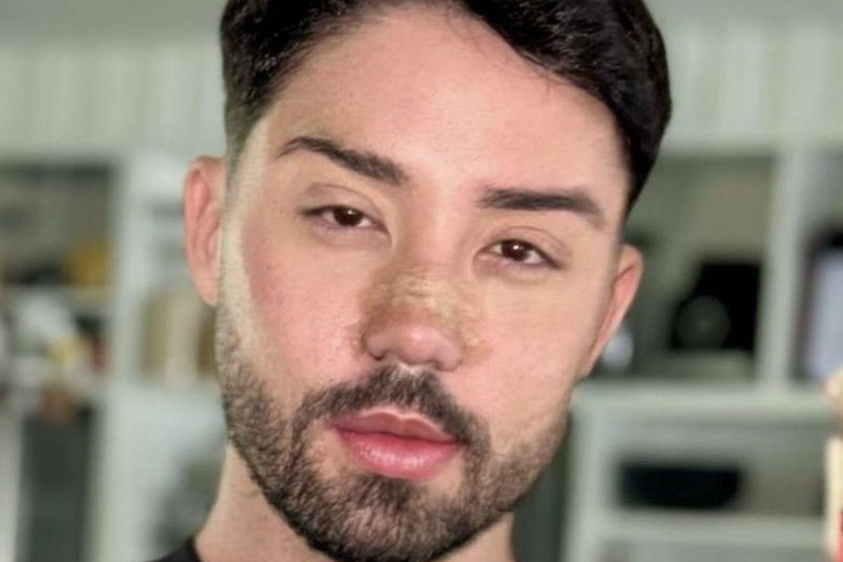 Rico Melquiades mostra resultado do rosto em novas plásticas (Reprodução/Instagram)