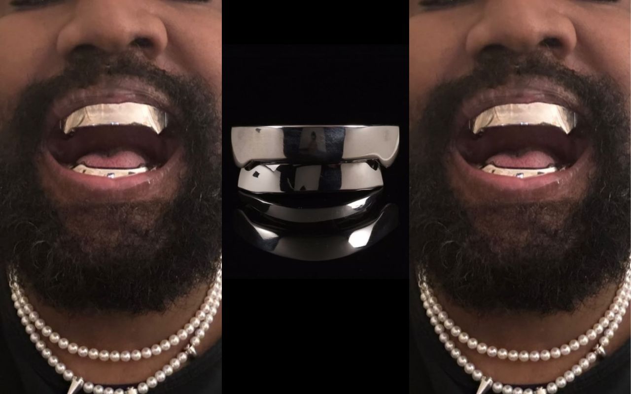 Kanye West troca todos os dentes por próteses de R$ 4 milhões