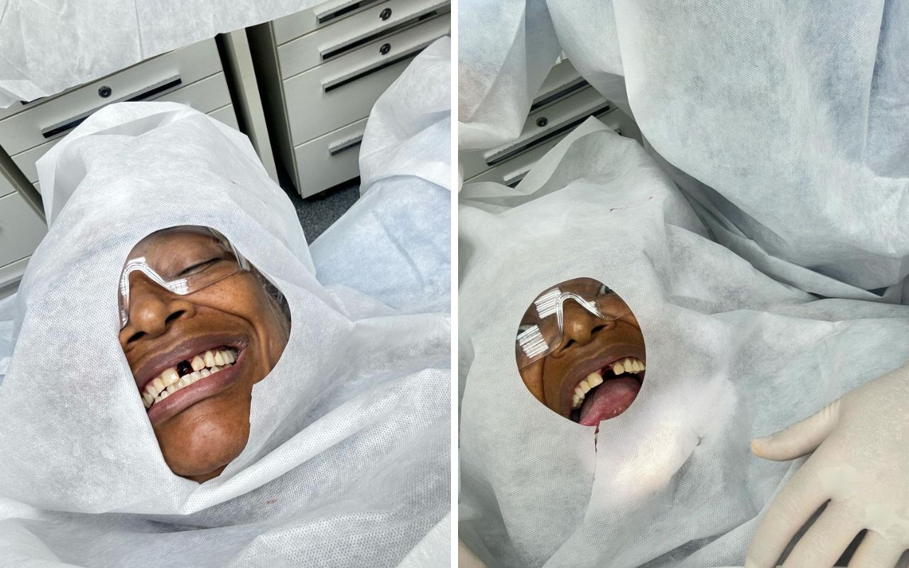 Mart'nália quebra o dente em acidente no palco – Foto: Instagram