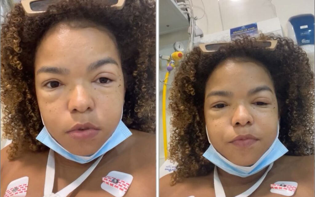 Jeniffer Nascimento tem crise alérgica após comer lagosta – Foto: Reprodução Instagram