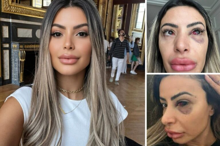 Janaína Prazeres: Saiba tudo sobre a modelo agredida em Paris