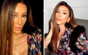 Entenda os procedimentos estéticos realizados por Maya Massafera na sua transição