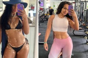 Natália Deodato emagrece