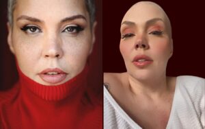 Simony sobre superar o câncer: ‘Enfrentei abismos mais profundos da dor’