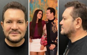 Esposa de Ximbinha elogia nova aparência do músico após harmonização facial
