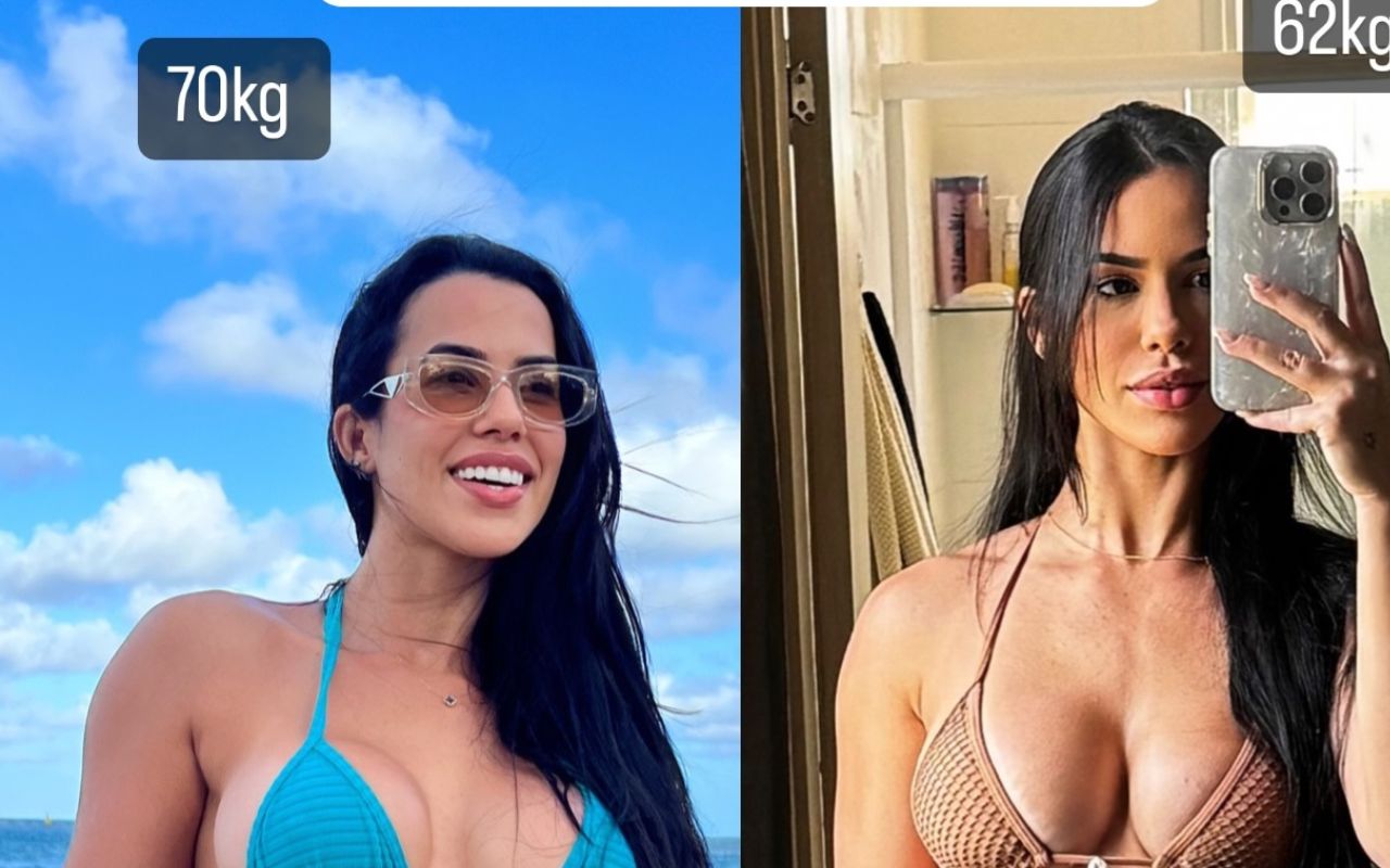Ex-BBB Larissa antes e depois — Foto: Reprodução/Instagram