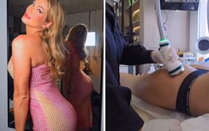Lívia Andrade faz procedimento para ficar com bumbum matador
