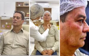 Marcello Antony faz harmonização facial. Veja o resultado!