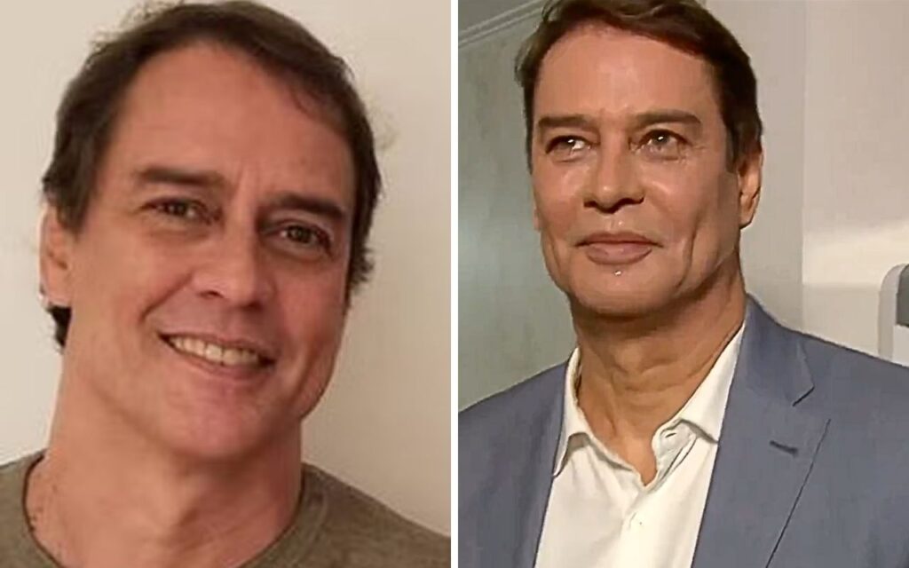 Marcello Antony faz harmonização facial. Veja o resultado!