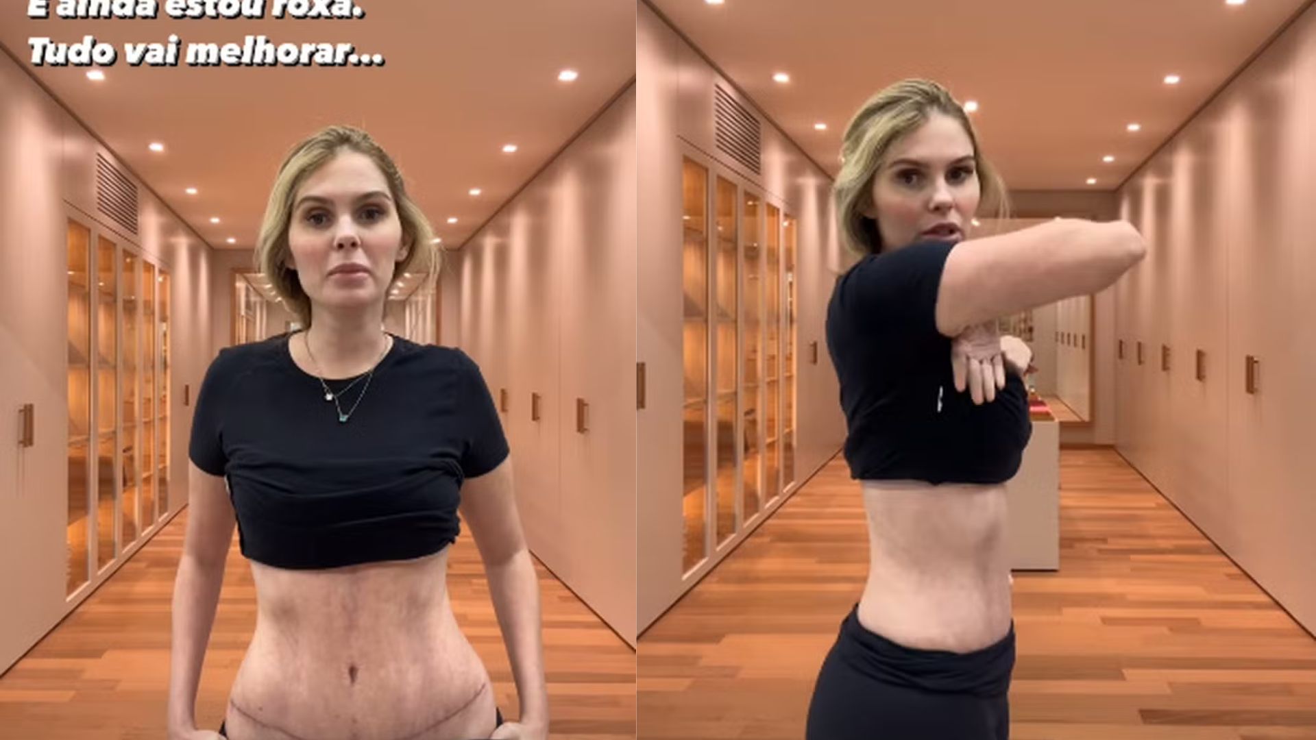 Bárbara Evans mostra como está seu corpo após cirugias