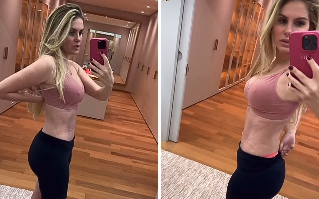 Bárbara Evans mostra sua recuperação após cirurgias estéticas