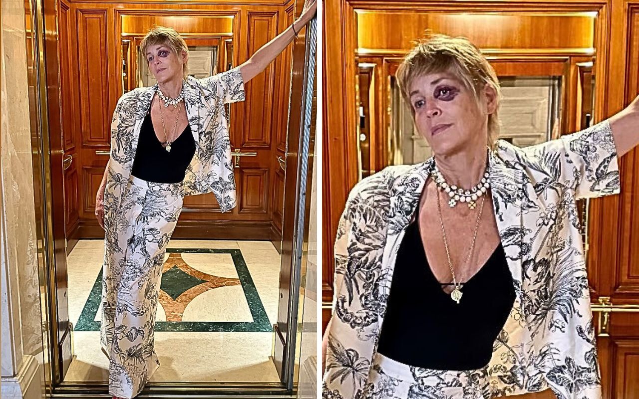 Sharon Stone mostra olho roxo durante férias na Turquia