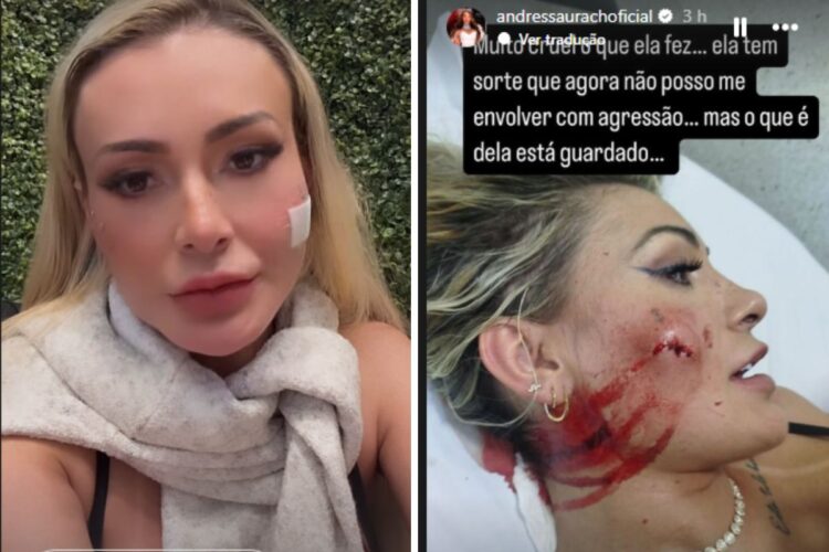 Andressa Urach