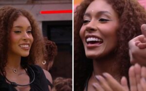 Giovanna Jacobina, do BBB 25, detalha cirurgia ortognática que transformou seu rosto e solucionou problemas como apneia e dores.