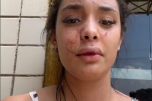 milena, mulher agredida por bia miranda