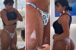 Gretchen faz novos procedimentos estéticos