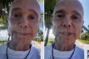 Netinho raspa a cabeça