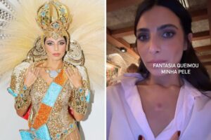 Rayssa Bratillieri machucada