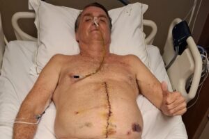 Jair Bolsonaro internado