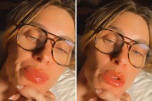 Carolina Dieckmann exibe lábios inchados