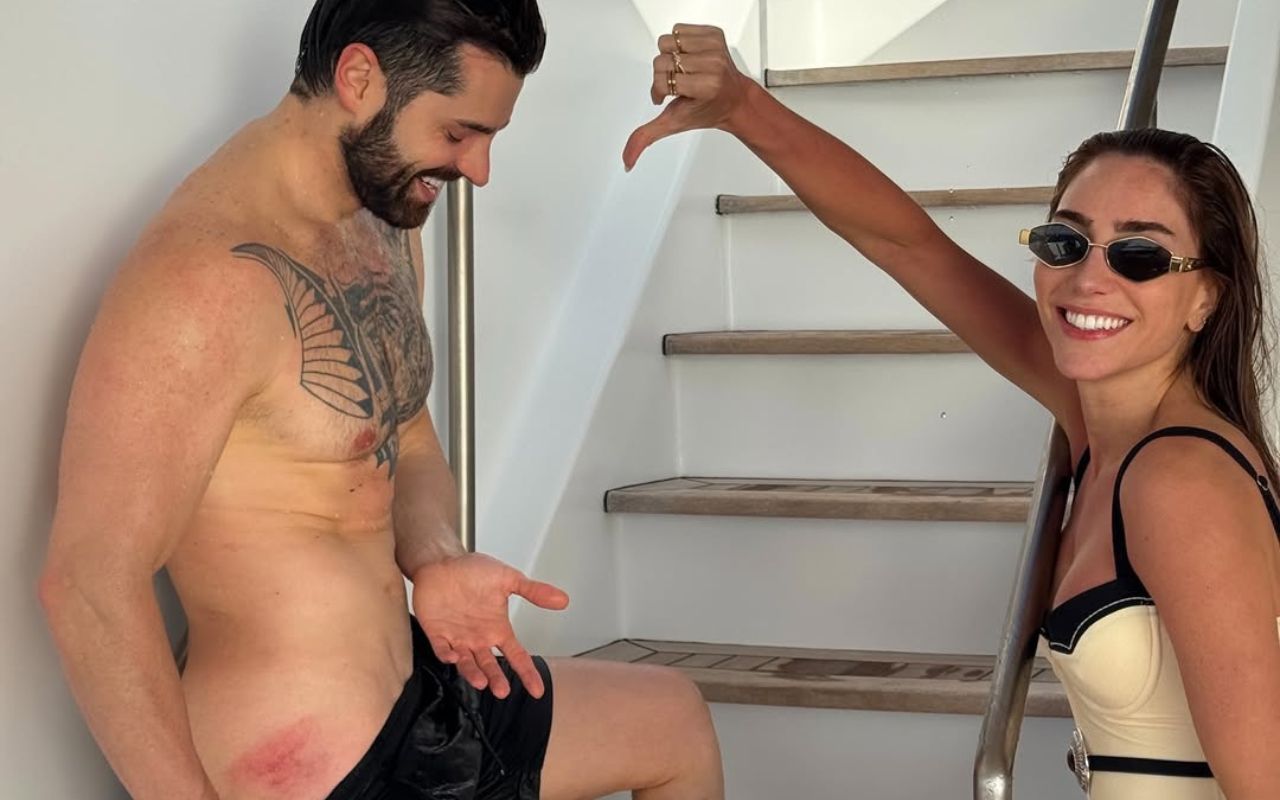 Alok sofre perrengue na Europa e mostra machucados da viagem em família