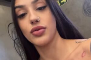 bia miranda com machucado após acidente de carro