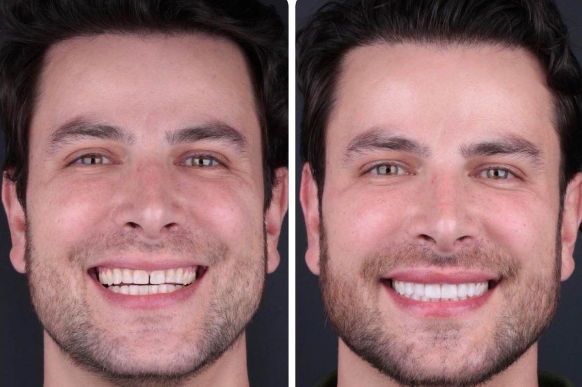 Ex-BBB Gustavo Marsengo