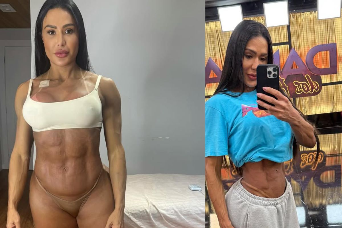 fotomontagem de gracyanne barbosa após cirurgia e no dança dos famosos