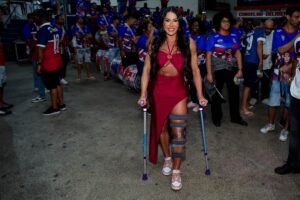 Gracyanne vai de muletas à quadra da União da Ilha