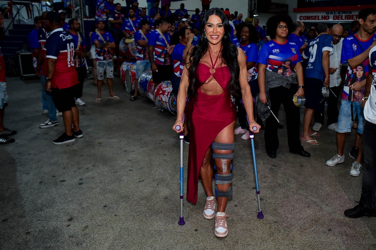 Gracyanne vai de muletas à quadra da União da Ilha