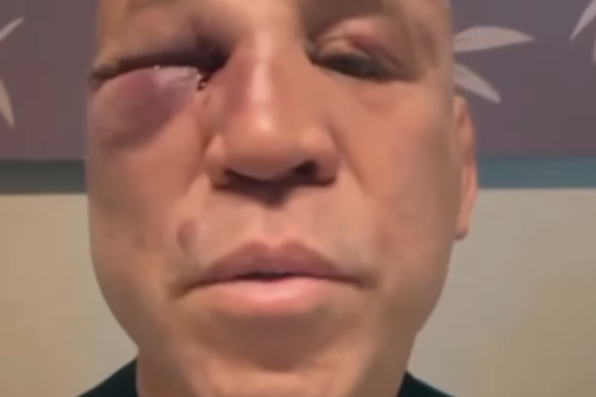 wanderlei silva machucado