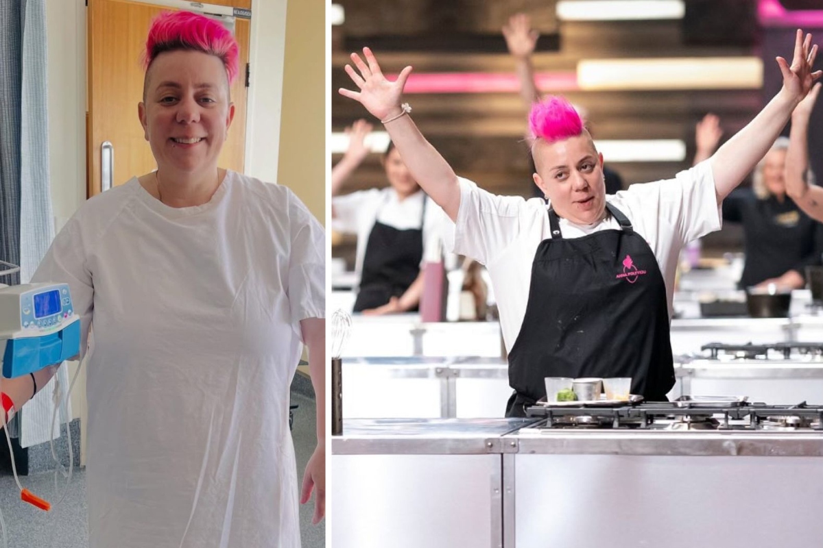 Ex-MasterChef Anna revela doença rara